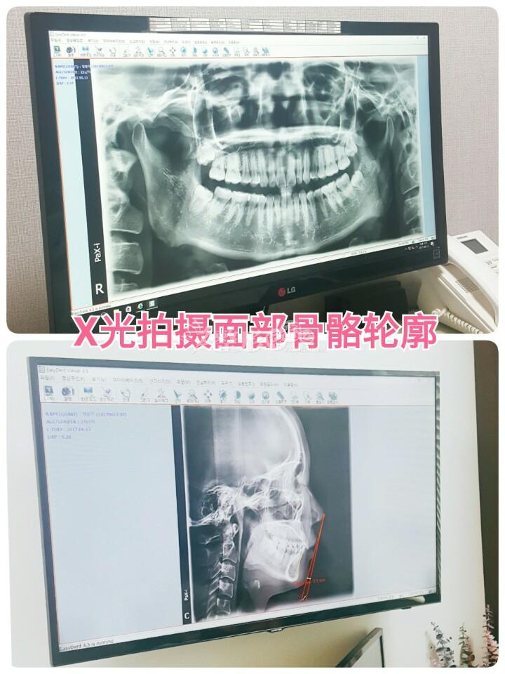 穷人也能富起来探索小规模养殖业的秘诀